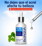 Kit Antiacné Bioaqua – Limpieza Profunda y Piel Sin Imperfecciones
