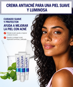 Kit Antiacné Bioaqua – Limpieza Profunda y Piel Sin Imperfecciones